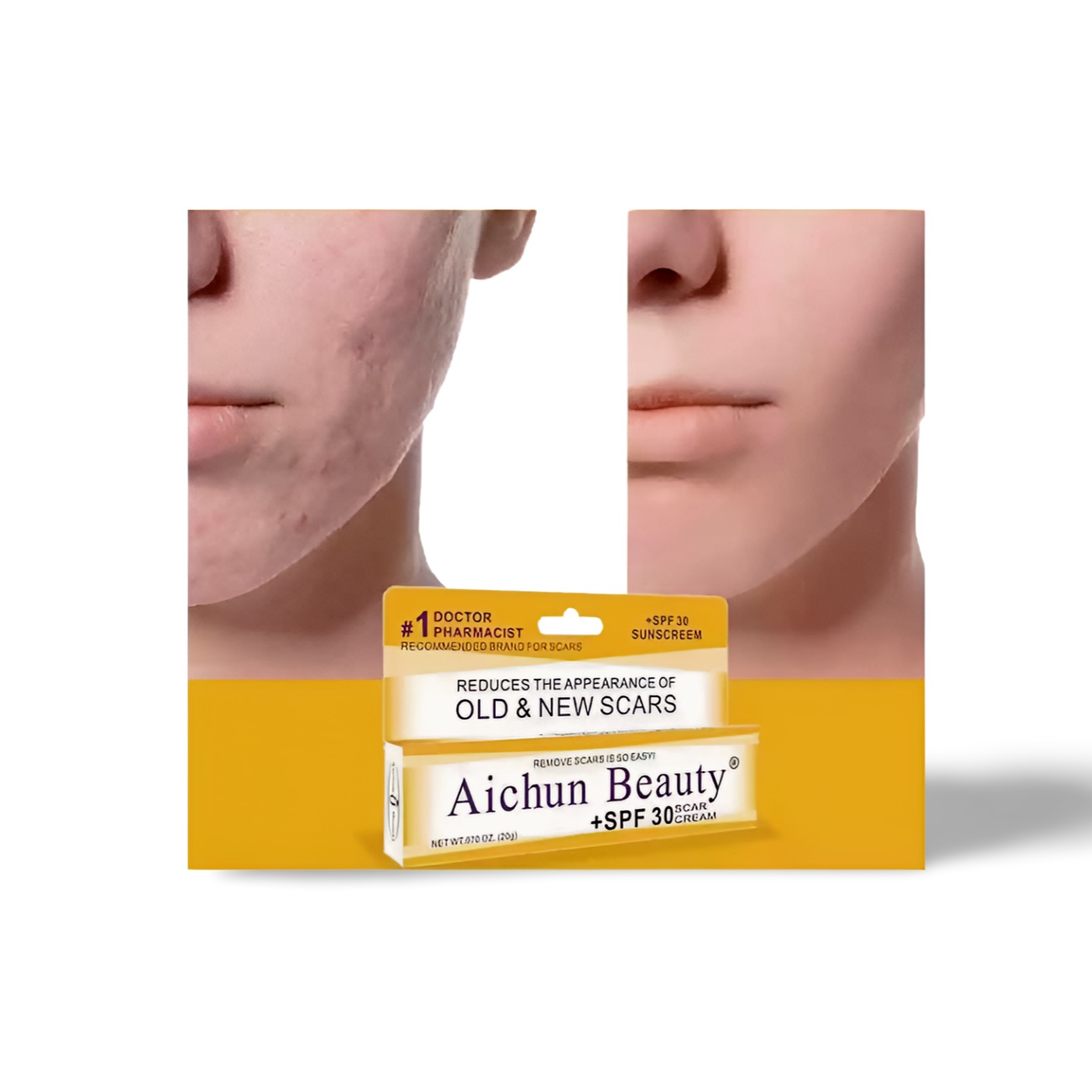 Aichun Beauty Scar Cream