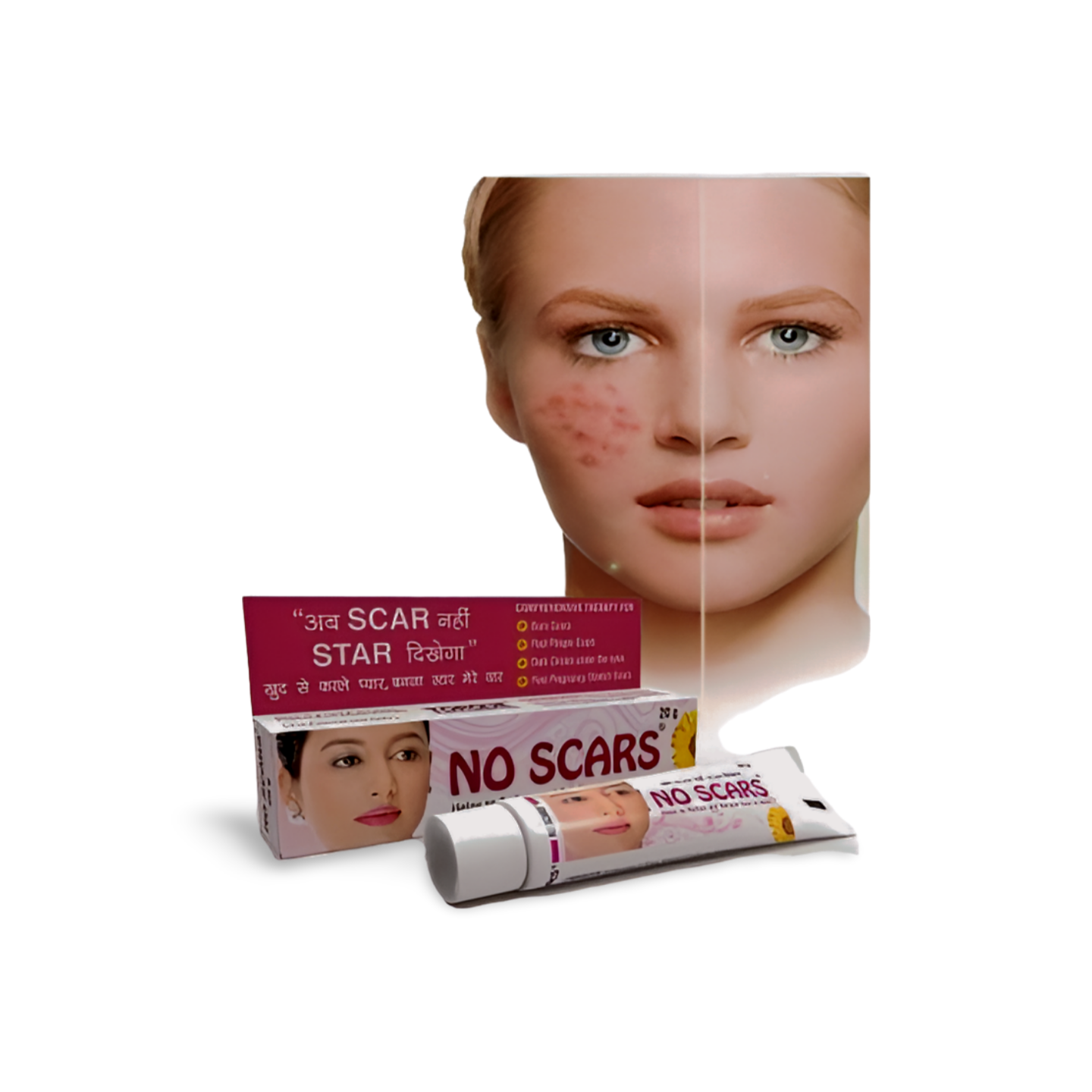 No Scars Cream