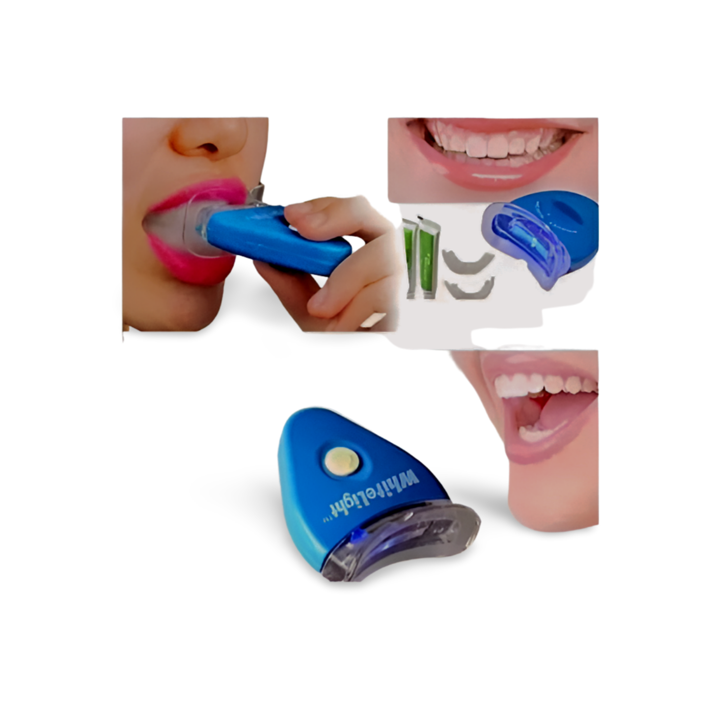 White Light Teeth Whitener